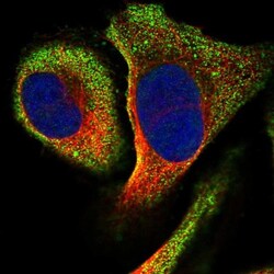 RSAD1 Antibody, Novus Biologicals:Antibodies:Primary Antibodies